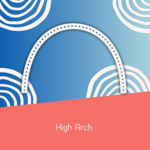High Arch
